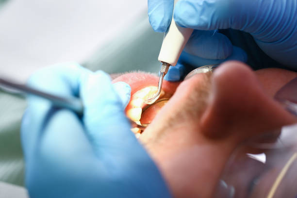 Best Emergency Dental Services for Seniors in Princeton, WV