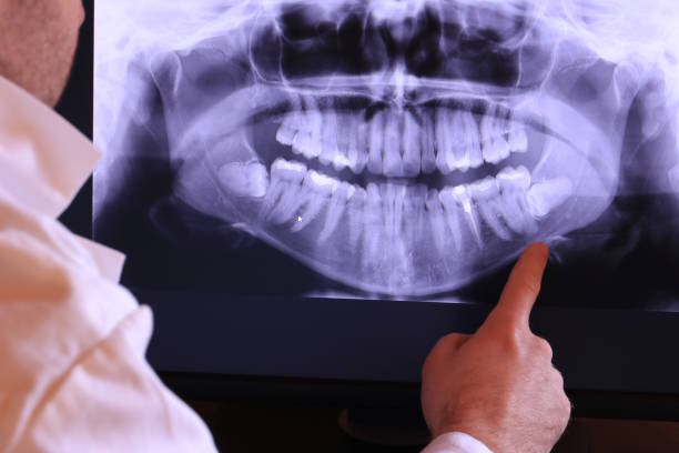 Best Emergency Dental Care for Abscessed Tooth in Princeton, WV